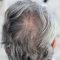 Top Hair Products for Thinning Hair in Men